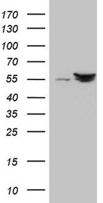 SHMT2 Antibody in Western Blot (WB)