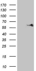 SHMT2 Antibody in Western Blot (WB)