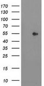 SHPK Antibody in Western Blot (WB)