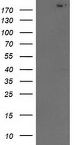 SHPRH Antibody in Western Blot (WB)