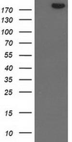 SHPRH Antibody in Western Blot (WB)