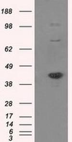 SIL1 Antibody in Western Blot (WB)