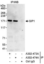 SIP1 Antibody in Immunoprecipitation (IP)