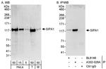 SIPA1 Antibody in Western Blot (WB)