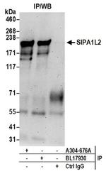 SIPA1L2 Antibody in Immunoprecipitation (IP)