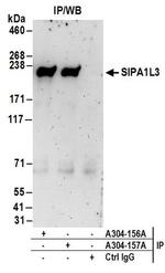 SIPA1L3 Antibody in Immunoprecipitation (IP)