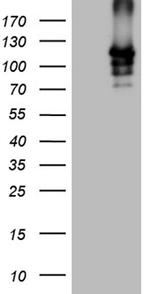 SIRT1 Antibody in Western Blot (WB)