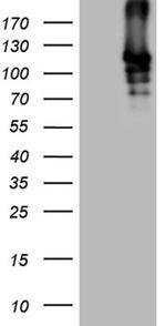 SIRT1 Antibody in Western Blot (WB)