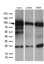 SIRT1 Antibody in Western Blot (WB)