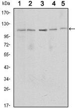 SIRT1 Antibody in Western Blot (WB)