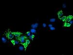 SIRT5 Antibody in Immunocytochemistry (ICC/IF)