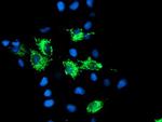 SIRT5 Antibody in Immunocytochemistry (ICC/IF)