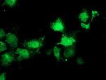 SIRT5 Antibody in Immunocytochemistry (ICC/IF)