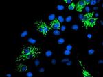 SIRT5 Antibody in Immunocytochemistry (ICC/IF)