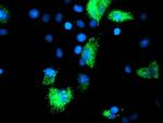 SIRT5 Antibody in Immunocytochemistry (ICC/IF)