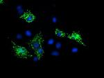 SIRT5 Antibody in Immunocytochemistry (ICC/IF)