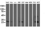 SIRT5 Antibody in Western Blot (WB)