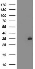 SIRT5 Antibody in Western Blot (WB)