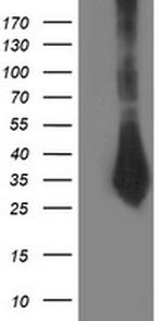 SIRT5 Antibody in Western Blot (WB)