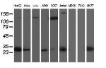 SIRT5 Antibody in Western Blot (WB)