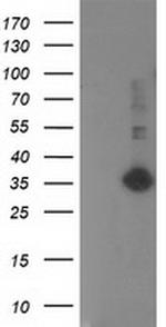 SIRT5 Antibody in Western Blot (WB)