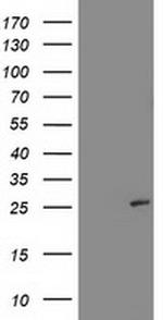 SIRT5 Antibody in Western Blot (WB)
