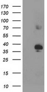 SIRT6 Antibody in Western Blot (WB)