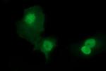 SIVA1 Antibody in Immunocytochemistry (ICC/IF)