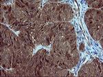 SIVA1 Antibody in Immunohistochemistry (Paraffin) (IHC (P))