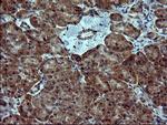 SIVA1 Antibody in Immunohistochemistry (Paraffin) (IHC (P))