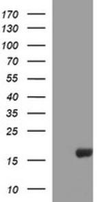 SIVA1 Antibody in Western Blot (WB)