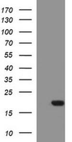 SIVA1 Antibody in Western Blot (WB)