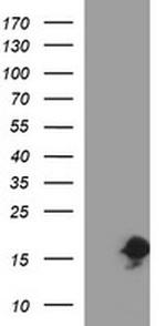 SIVA1 Antibody in Western Blot (WB)