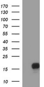 SIVA1 Antibody in Western Blot (WB)