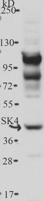 KCNN4 Antibody in Western Blot (WB)