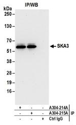 SKA3 Antibody in Immunoprecipitation (IP)