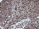 SKIL Antibody in Immunohistochemistry (Paraffin) (IHC (P))