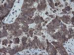 SKIL Antibody in Immunohistochemistry (Paraffin) (IHC (P))