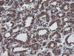 SKIL Antibody in Immunohistochemistry (Paraffin) (IHC (P))