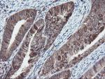 SKIL Antibody in Immunohistochemistry (Paraffin) (IHC (P))