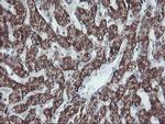 SKIL Antibody in Immunohistochemistry (Paraffin) (IHC (P))