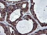 SKIL Antibody in Immunohistochemistry (Paraffin) (IHC (P))