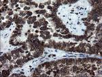 SKIL Antibody in Immunohistochemistry (Paraffin) (IHC (P))