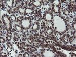 SKIL Antibody in Immunohistochemistry (Paraffin) (IHC (P))