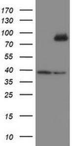 SKIL Antibody in Western Blot (WB)