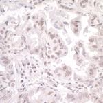 SKIV2L2 Antibody in Immunohistochemistry (IHC)