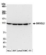 SKIV2L2 Antibody in Western Blot (WB)