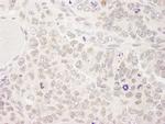 SKIV2L2 Antibody in Immunohistochemistry (IHC)