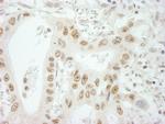 SKIV2L2 Antibody in Immunohistochemistry (IHC)