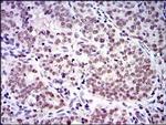 SKP1 Antibody in Immunohistochemistry (Paraffin) (IHC (P))